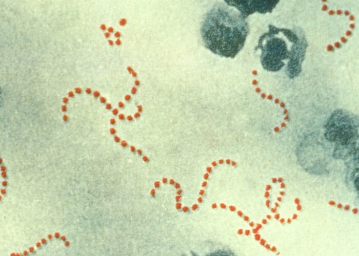 Photomicrograph of Streptococcus pyogenes bacteria